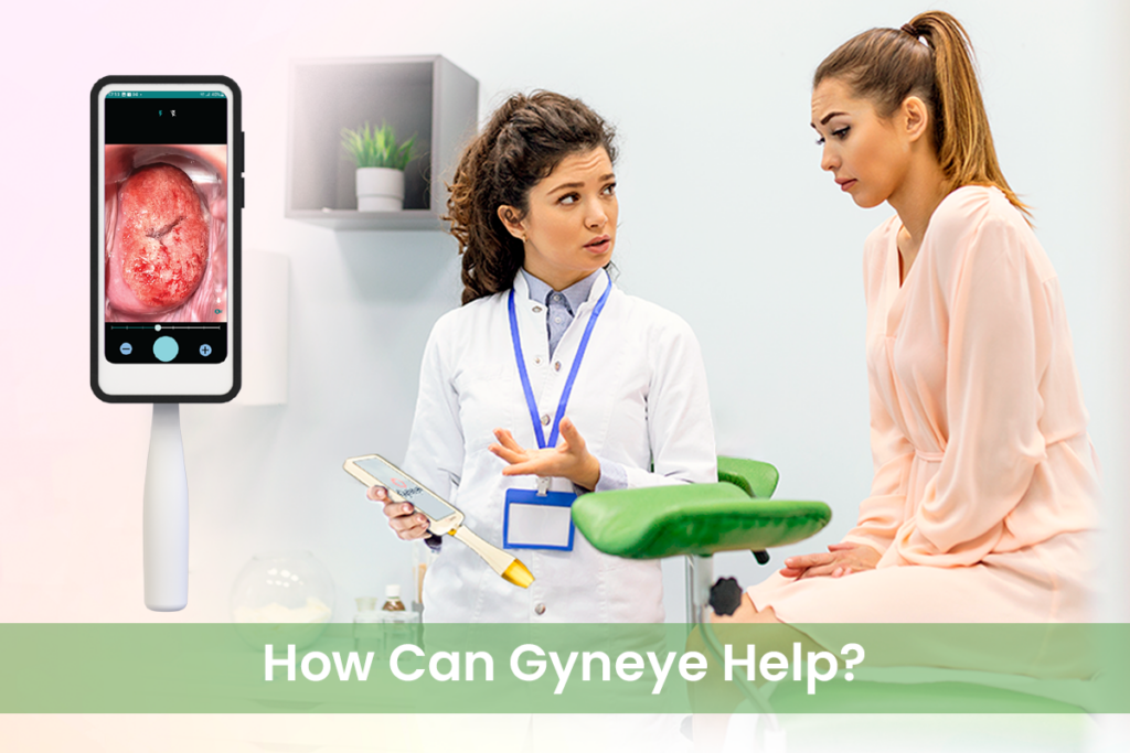 Colposcopy images